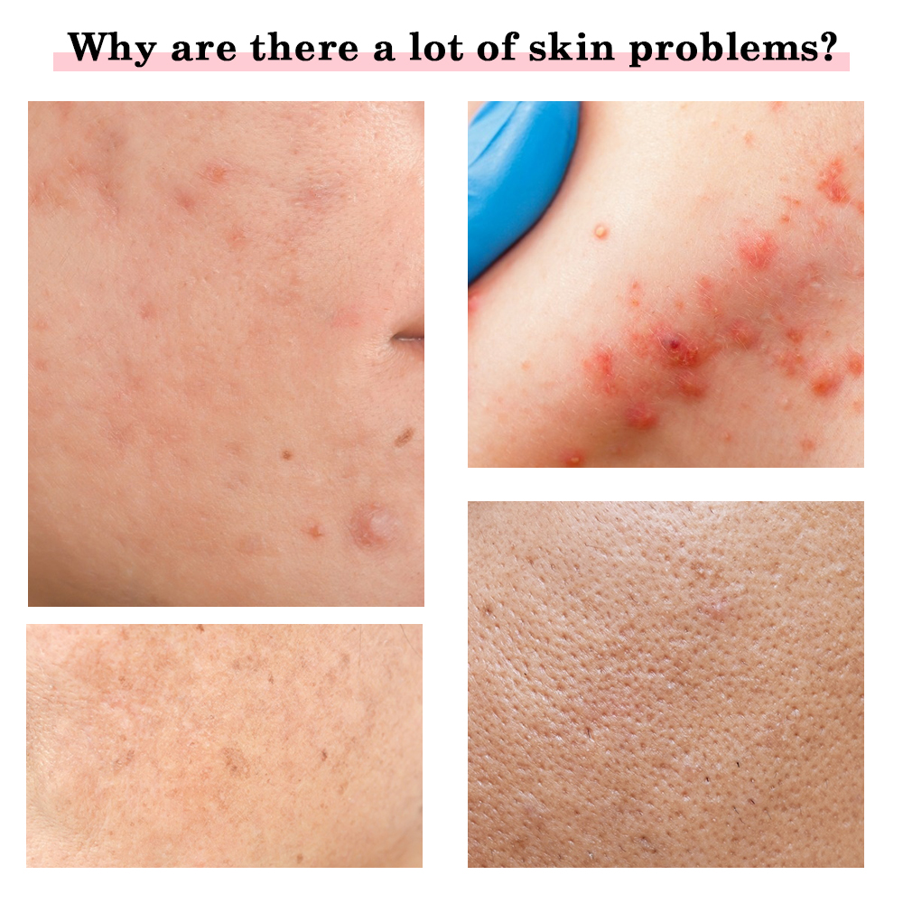 7 em 1 dispositivos de face lift