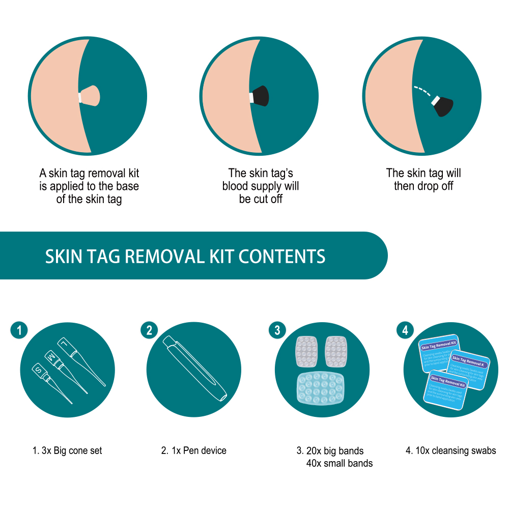 Lescolton auto removedor de tag de pele 3 em 1 kit