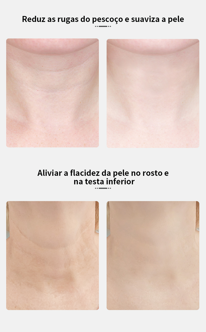 Anlan pescoço rosto beleza dispositivo 3 Anlan pescoço rosto beleza dispositivo 3