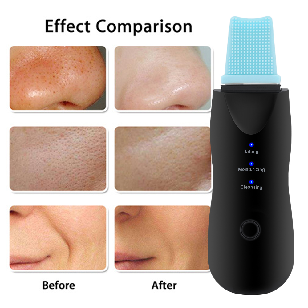 Purificador ultra-sônico da pele Purificador ultra-sônico da pele