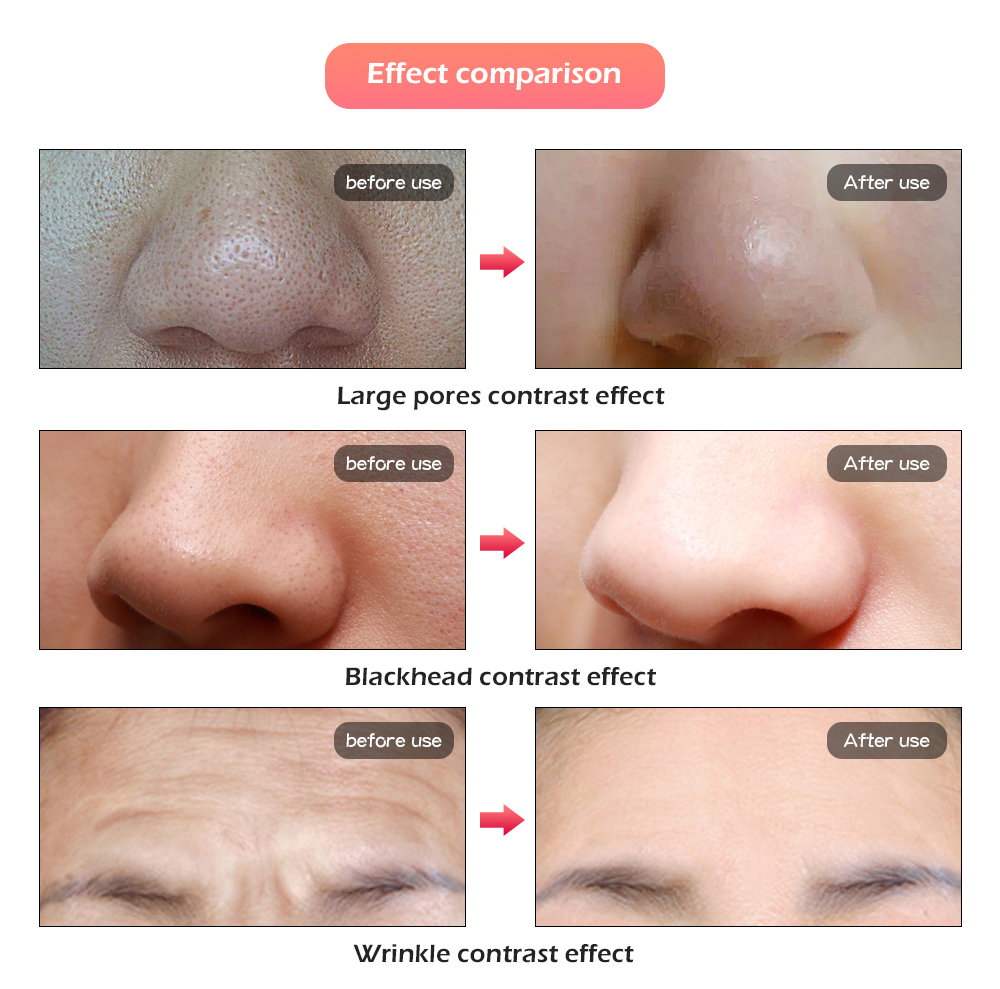 Máscara de terapia de fótons. led com 7 cores